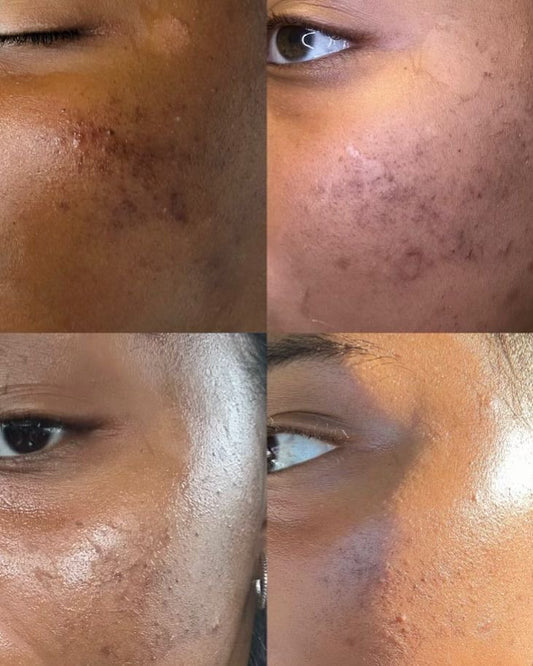 Savon Curcuma & miel Anti - taches