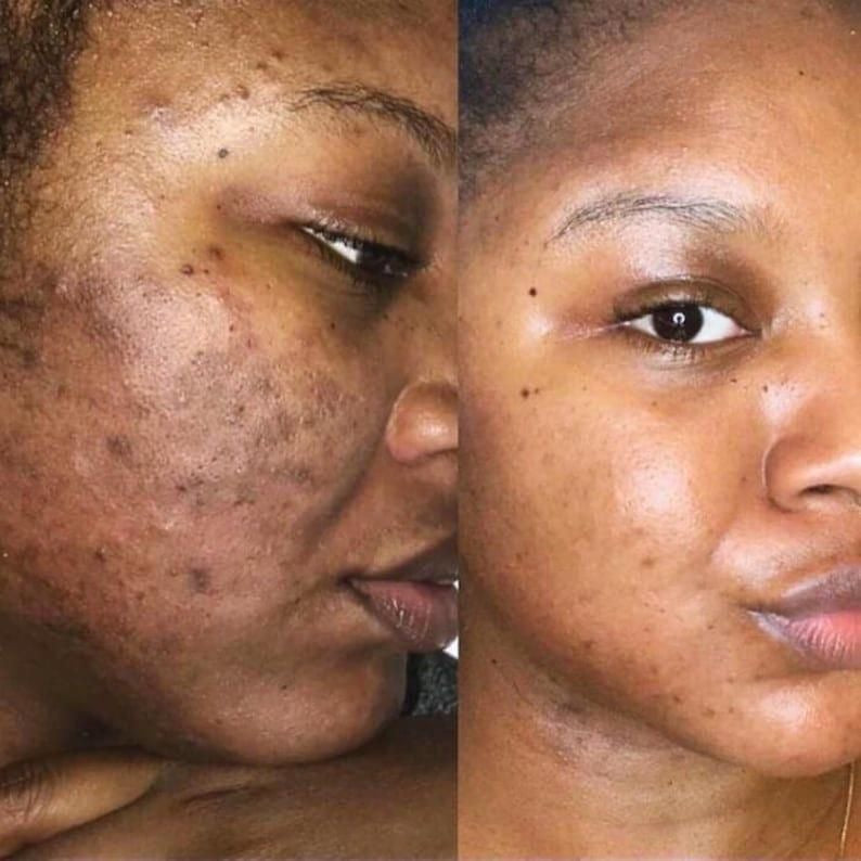 Savon Curcuma & miel Anti - taches